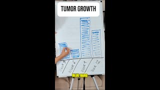 #shorts How Dairy Can Cause TUMOR Growth