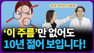 얼굴에 '이 주름'은 10년 더 늙어보이게 합니다.. (10년 늙어보이는 주름 3가지)