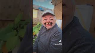 #stroke #funny #dad #youtube #tiktok