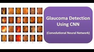 Glaucoma Detection Using CNN (Convolutional Neural Network) | Glaucoma Classification Using Matlab