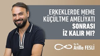 Erkeklerde Meme Küçültme Ameliyatından Sonra İz Kalır Mı?