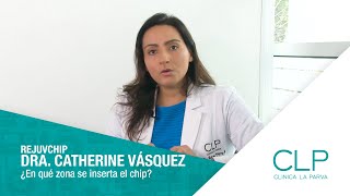 DRA. CATHERINE VÁSQUEZ| ¿En qué zona se inserta el chip?| CLÍNICA LA PARVA