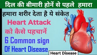 Heart Disease| दिल की बीमारी होने पर मिलने वाले संकेत| Important sign of heart disease@MedicineTak