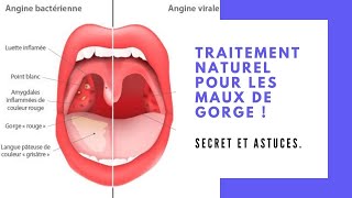 Les docteurs ne parlent jamais de cette astuce pour supprimer les maux de gorge ! secret et astuces.