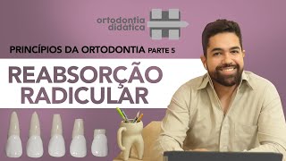 REABSORÇÃO RADICULAR - Princípios da Ortodontia -  Parte 5