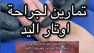 تمارين لعلاج تيبس أوتار اليد و الاصابع بعد جراحة يد how to get rid of hand/fingers stiffness