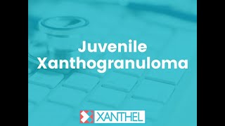 Juvenile Xanthogranuloma, Help And Support With Juvenile Xanthogranuloma - By XANTHEL ®