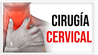 ▷ Cirugía de columna mínimamente invasiva | Remplazo del Disco Cervical | Biziondo