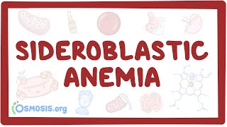 Sideroblastic anemia - causes, symptoms, diagnosis, treatment, pathology