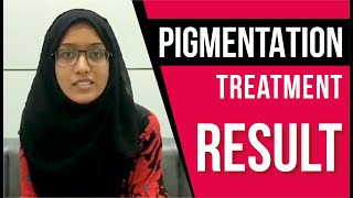 Real Stories: Pigmentation Treatment Success | Honest Patient Feedback | Sakhiya Skin Clinic Reviews