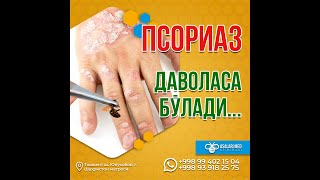 ПСОРИАЗНИ ДАВОЛАСА БЎЛАДИ... #psoriasis #asalarimed #psoriaz