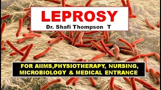 LEPROSY// AIIMS/ PHYSIOTHERAPY/ NURSING/MEDICAL ENTRANCE/ Dr.Shafi Thompson