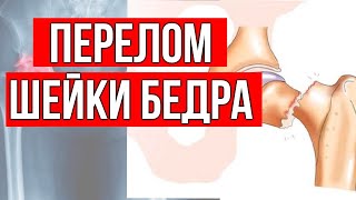 Перелом шейки бедра. Реабилитация