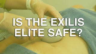 Is the Exilis Elite safe? | The Body Clinic | Exilis Elite Fat Reduction FAQ 🎯