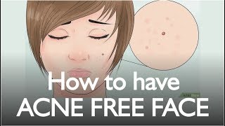 How to have ACNE FREE FACE | Walkthrough