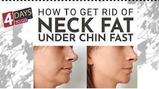 DAY 4 OF 10 | DOUBLE CHIN + FACE FAT + NECK FAT | LOOK YOUNGER WITH BABY FACE|FITFLEX|