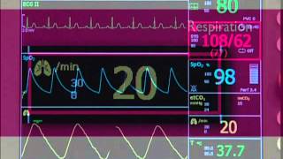 Respiration VM Series