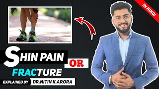 Shin Splints or Stress Fracture? | Nitin Kr. Arora | PhyX Pain Solutions