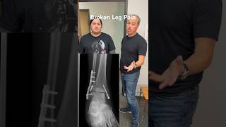 Broken Leg, Neck & Back pain Construction Worker treated by Chiropractor  @SoCalChiropractic