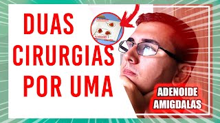 Adenoide e Amígdalas: Quase morri por causa disso...