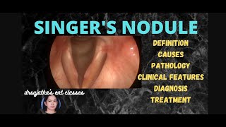 176.vocal nodule #stroboscopy #anatomylectures #surgeryeducation #voicestatus