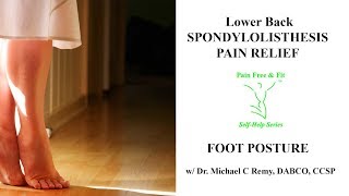 Spondylolisthesis Self Treatment- Foot Posture and Low Back Pain Relief