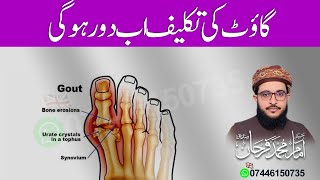 Gout Ki Takleef ka Ailaj | گاؤٹ کی تکلیف کا علاج | Gout Treatment | Farhan Siddique