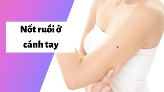 Xem bói ý nghĩa nốt ruồi ở cánh tay Trái, Phái ở Nam, Nữ? Có giàu không?