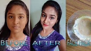 Magical Mask to Remove Sun Tan Instantly From Face | Rupsha Das