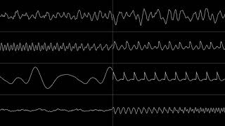 Torchkas - "Super Meat Boy - Hot Damned (SNES Cover)" [Oscilloscope View]