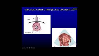 Các mặt cắt siêu âm tim cơ bản