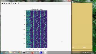 Heart Disease detection from ECG Signal Dataset using Machine learning | ieee project demo