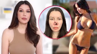 Plastic Surgery I REGRET Having: Beware of These Procedures