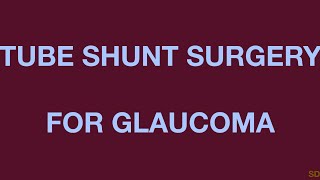 Glaucoma: Session 30: Tube Shunts (Glaucoma Drainage Implants)