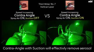 NSK Comparison - Contra-angle with suction or with NO suction