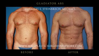 Dr. Steinbrech Live | Male Plastic Surgery Discussion