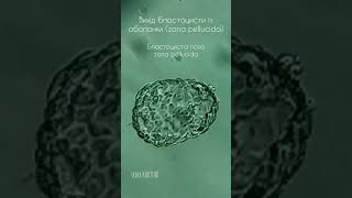 Вилуплення бластоцисти людини із оболонки - zona pellucida. #life #embryologist #biology #blastocyst