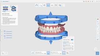 How to use Medit Model Maker HOLLOW with Drain Holes from ANY Scanner - IDDA MiniBytes Tutorials