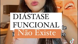 Diástase tem tratamento não cirúrgico