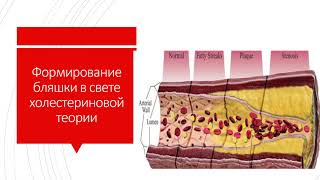 Сердечно-сосудистые заболевания у ВИЧ+ людей и их профилактика