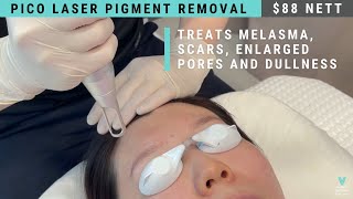 PICO Laser Treatment Singapore 皮秒激光  | $88  - V Medical Aesthetics & Laser Clinic.