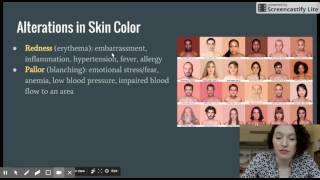 Integumentary System - Skin  Color