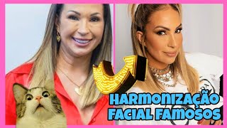 🔴 Famosos Que Fizeram Harmonização Facial - Top 14! Tô em choque com a mudança!😱 #famosos