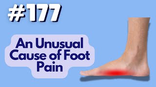 An Unusual Cause of Foot Pain, Menta Chiropractic LLC in Milford, CT | Dr. Franco Menta