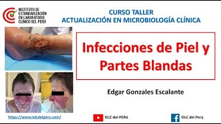 MÓDULO II - Taller Día 3 Infecciones de la piel y partes blandas