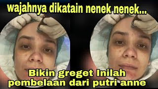 Tak terima wajahnya dikatain nenek nenek.... Inilah pembelaan dari putri anne