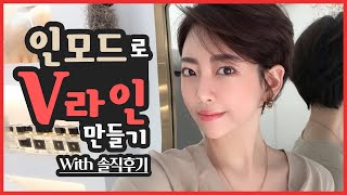 인모드로 V라인 만들기 with 솔직후기 by 닥터개굴 피부과전문의