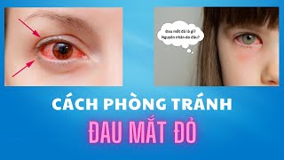 Đau mắt đỏ lây qua đường nào và cách phòng tránh