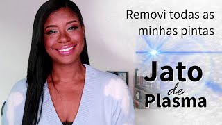 Removi todas as minhas pintas com Jato de Plasma