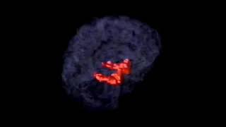 Hippocampus 3D Brain animation